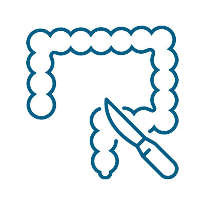 Colon Surgery
