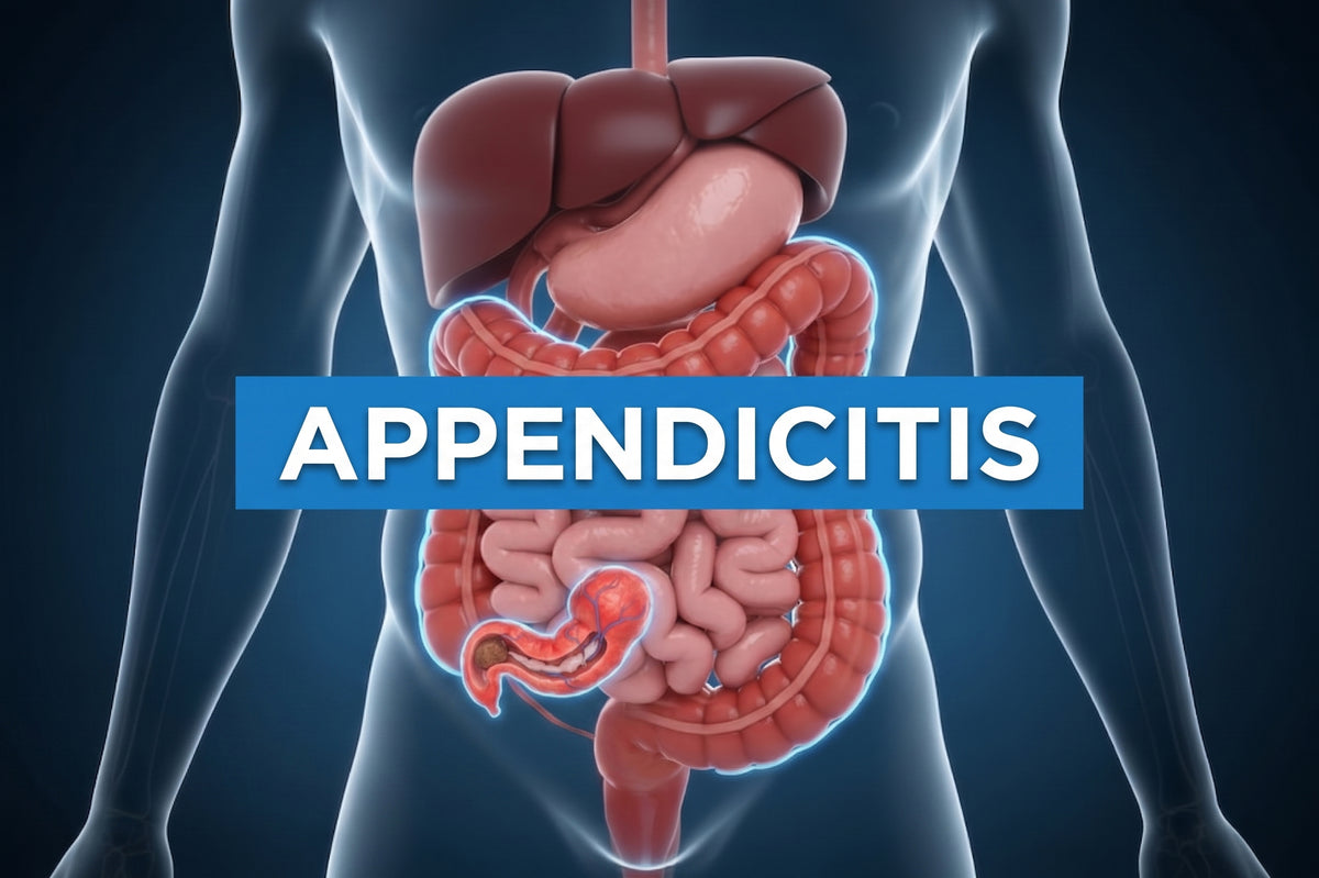 Appenditis | DAP